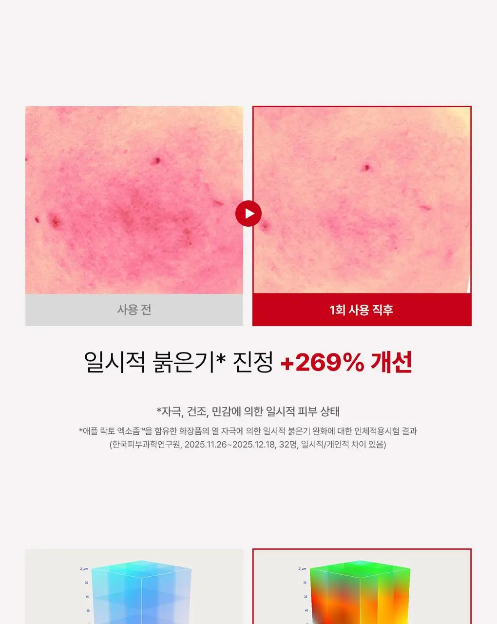 [NEW/단독기획] rdrd 레드 애플 락토 진정 팝핑 토너 95g 응급진정 KIT 기획 상세페이지 24